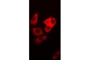 Immunofluorescent analysis of DAP staining in MCF7 cells. (DAP anticorps)