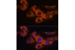 Immunofluorescence analysis of C6 cells using NDRG4 antibody  at dilution of 1:100. (NDRG4 anticorps  (AA 140-220))