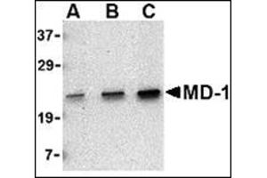 Western blot analysis of MD-1 in Daudi cell lysate with this product at (A) 0. (LY86 anticorps  (C-Term))