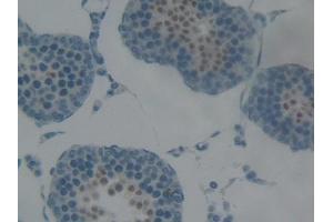 Used in DAB staining on fromalin fixed paraffin- embedded kidney tissue (Cytokeratin 5 anticorps  (AA 335-473))