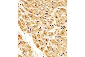 Paraformaldehyde-fixed, paraffin embedded Human heart tissue, Antigen retrieval by boiling in sodium citrate buffer (pH6.