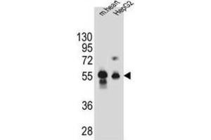 Western Blotting (WB) image for anti-Dipeptidase 3 (DPEP3) antibody (ABIN2995842) (DPEP3 anticorps)