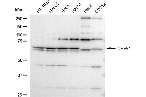 Western blotting analysis using CPEB1 antibody (ABIN7798266).