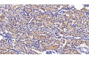 Detection of LIFR in Porcine Kidney Tissue using Polyclonal Antibody to Leukemia Inhibitory Factor Receptor (LIFR)
