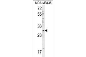 DTWD1 Antibody (Center) (ABIN655477 and ABIN2845000) western blot analysis in MDA-M cell line lysates (35 μg/lane). (DTWD1 anticorps  (AA 144-173))