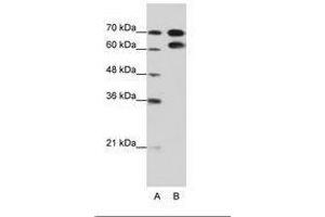 Image no. 2 for anti-Ribonucleoprotein, PTB-Binding 1 (RAVER1) (AA 24-73) antibody (ABIN202804) (RAVER1 anticorps  (AA 24-73))