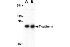 Western Blotting (WB) image for anti-Cadherin 13 (CDH13) (N-Term) antibody (ABIN1031598) (Cadherin 13 anticorps  (N-Term))