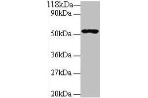 Western blot All lanes: GLP1R antibody at 2 μg/mL + 293T whole cell lysate Secondary Goat polyclonal to rabbit IgG at 1/10000 dilution Predicted band size: 54 kDa Observed band size: 54 kDa (GLP1R anticorps  (AA 24-145))