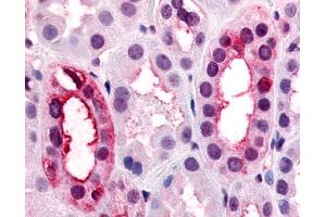 Anti-VN1R1 antibody IHC of human kidney, renal tubules.
