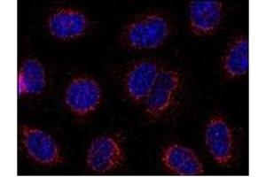 Immunofluorescence (IF) image for anti-Stromal Interaction Molecule 1 (STIM1) (C-Term), (Cytoplasmic Domain) antibody (ABIN238397)