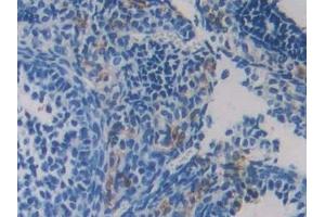 Detection of RIPK3 in Mouse Ovary Tissue using Polyclonal Antibody to Receptor Interacting Serine Threonine Kinase 3 (RIPK3)