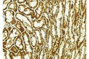ABIN6278080 at 1/100 staining Mouse kidney tissue by IHC-P. (HIPK2 anticorps  (N-Term))
