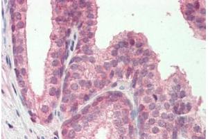 Human, Prostate: Formalin-Fixed Paraffin-Embedded (FFPE) (MZF1 anticorps  (N-Term))