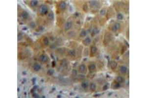 Used in DAB staining on fromalin fixed paraffin-embedded Liver tissue (Retinol Binding Protein 5 anticorps  (AA 19-201))