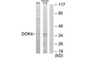 Western blot analysis of extracts from 293/mouse lung cells, using DOK4 Antibody. (DOK4 anticorps  (AA 11-60))