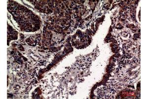 Immunohistochemistry (IHC) analysis of paraffin-embedded Human Lung, antibody was diluted at 1:100. (CD63 anticorps  (Internal Region))