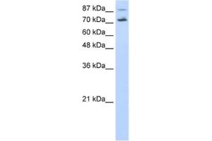 Western Blotting (WB) image for anti-Cell Division Cycle 25 Homolog B (S. Pombe) (CDC25B) antibody (ABIN2462389) (CDC25B anticorps)