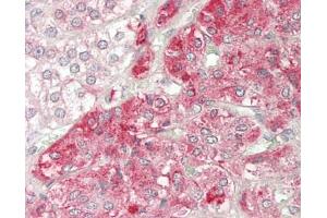 Human Adrenal: Formalin-Fixed, Paraffin-Embedded (FFPE).