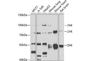 Western blot analysis of extracts of various cell lines, using ZAK antibody (ABIN6133445, ABIN6150360, ABIN6150361 and ABIN6223229) at 1:1000 dilution. (ZAK anticorps  (AA 1-330))