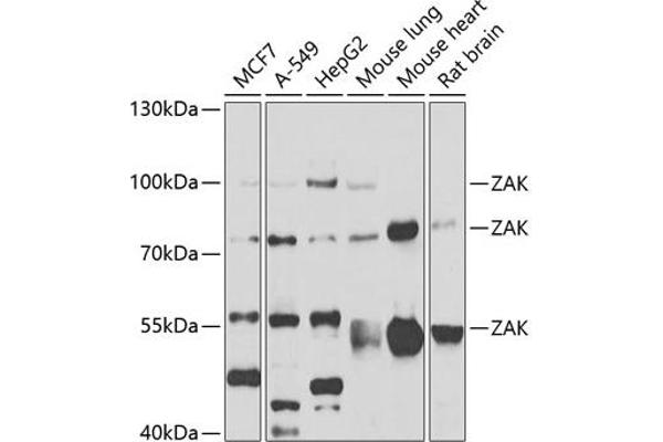 ZAK anticorps  (AA 1-330)