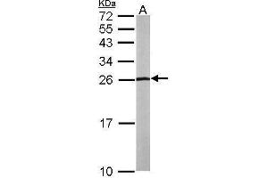 WB Image Sample (50 ug of whole cell lysate) A: mouse liver 15% SDS PAGE antibody diluted at 1:1000