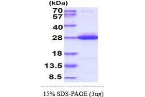 SDS-PAGE (SDS) image for GTPase Kras (KRAS) (AA 1-185) protein (His tag) (ABIN667031) (K-RAS Protein (AA 1-185) (His tag))