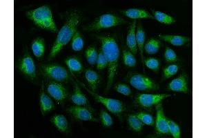 IF analysis of CYB5R3 using anti-CYB5R3 antibody (ABIN7600822).