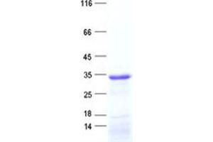 Validation with Western Blot