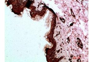 Immunohistochemical analysis of paraffin-embedded human-skin, antibody was diluted at 1:200