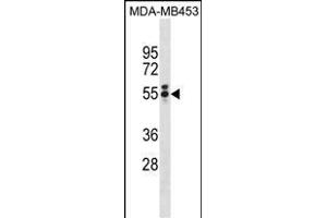 T Antibody (N-term) (ABIN1881864 and ABIN2839039) western blot analysis in MDA-M cell line lysates (35 μg/lane). (T Antigen (AA 15-43), (N-Term) anticorps)