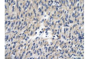Rabbit Anti-TCEAL1 antibody        Paraffin Embedded Tissue:  Human Heart cell   Cellular Data:  Epithelial cells of renal tubule  Antibody Concentration:   4. (TCEAL1 anticorps  (Middle Region))