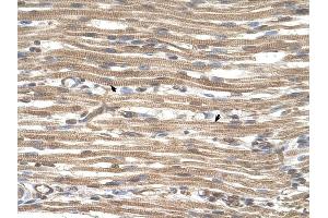 ACTR2 antibody was used for immunohistochemistry at a concentration of 4-8 ug/ml to stain Skeletal muscle cells (arrows] in Human Muscle. (ACTR2 anticorps)