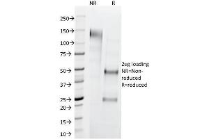 anti-Keratin 1 (KRT1) (C-Term) antibody