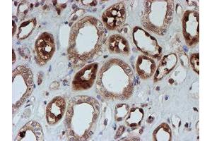 Immunohistochemical staining of paraffin-embedded Human Kidney tissue using anti-SAT2 mouse monoclonal antibody. (SAT2 anticorps)