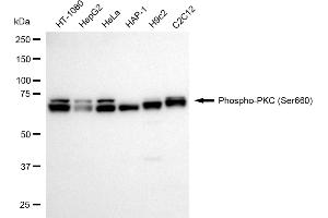 Western blotting analysis using phospho-PKC (Ser660) antibody (ABIN7799980).