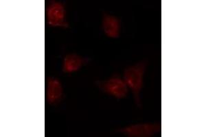 ABIN6275809 staining K562 by IF/ICC. (PTGIS anticorps  (Internal Region))