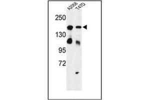 Western blot analysis of Vigilin / HDLBP Antibody (Center) in A2058, T47D cell line lysates (35ug/lane). (HDLBP anticorps  (Middle Region))