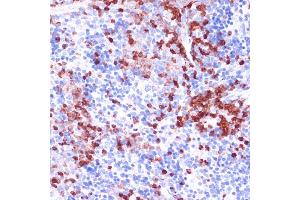 Immunohistochemistry of paraffin-embedded mouse spleen using WIPF1 antibody (ABIN7271348) at dilution of 1:100 (40x lens). (WIPF1 anticorps  (AA 400-500))
