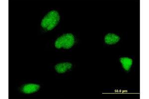 Immunofluorescence of monoclonal antibody to ZNF131 on HeLa cell. (ZNF131 anticorps  (AA 139-238))