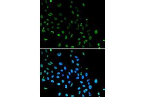Immunofluorescence analysis of A549 cells using XRCC5 antibody.