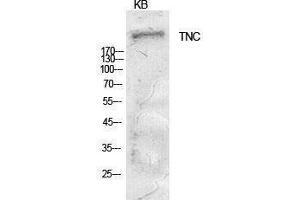 Western Blotting (WB) image for anti-Tenascin C (TNC) (Internal Region) antibody (ABIN3181403) (TNC anticorps  (Internal Region))