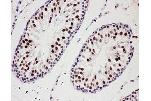 IHC-P: PIAS1 antibody testing of rat testis tissue