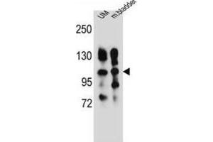 Western Blotting (WB) image for anti-Integrin, alpha 5 (ITGA5) antibody (ABIN2996588) (ITGA5 anticorps)