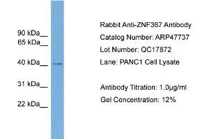 WB Suggested Anti-ZNF367  Antibody Titration: 0. (ZNF367 anticorps  (Middle Region))