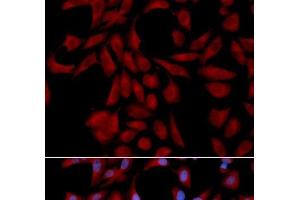 Immunofluorescence analysis of U2OS cells using UBE2I Polyclonal Antibody (UBE2I anticorps)
