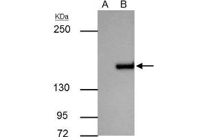 IP Image ROCK1 antibody immunoprecipitates ROCK1 protein in IP experiments. (ROCK1 anticorps  (N-Term))