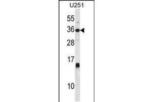 Western blot analysis in U251 cell line lysates (35ug/lane).