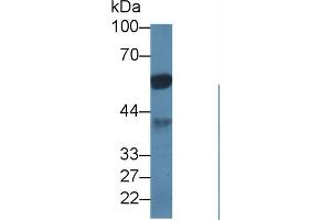 Western Blot; Sample: Porcine Cerebrum lysate; Primary Ab: 1µg/ml Rabbit Anti-Human PPP1Ca Antibody Second Ab: 0. (PPP1CA anticorps  (AA 2-330))