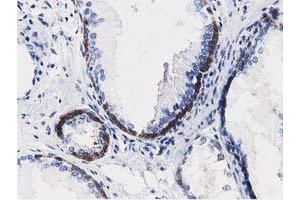 Immunohistochemical staining of paraffin-embedded Human Kidney tissue using anti-ALDH1L1 mouse monoclonal antibody. (ALDH1L1 anticorps)