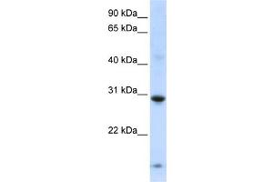 WB Suggested Anti-ZNF138 Antibody Titration:  0. (ZNF138 anticorps  (Middle Region))
